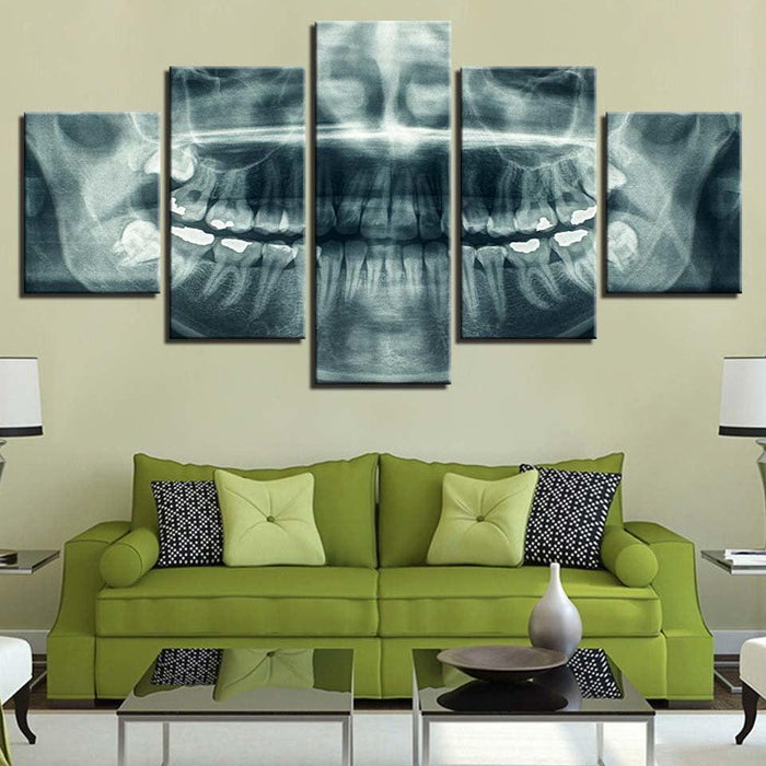 X-Ray 5 Piece HD Multi Panel Canvas Wall Art Frame - Original Frame