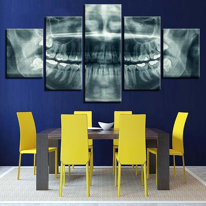 X-Ray Teeth 5 Piece HD Multi Panel Canvas Wall Art Frame