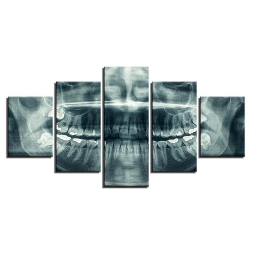 X-Ray 5 Piece HD Multi Panel Canvas Wall Art Frame - Original Frame