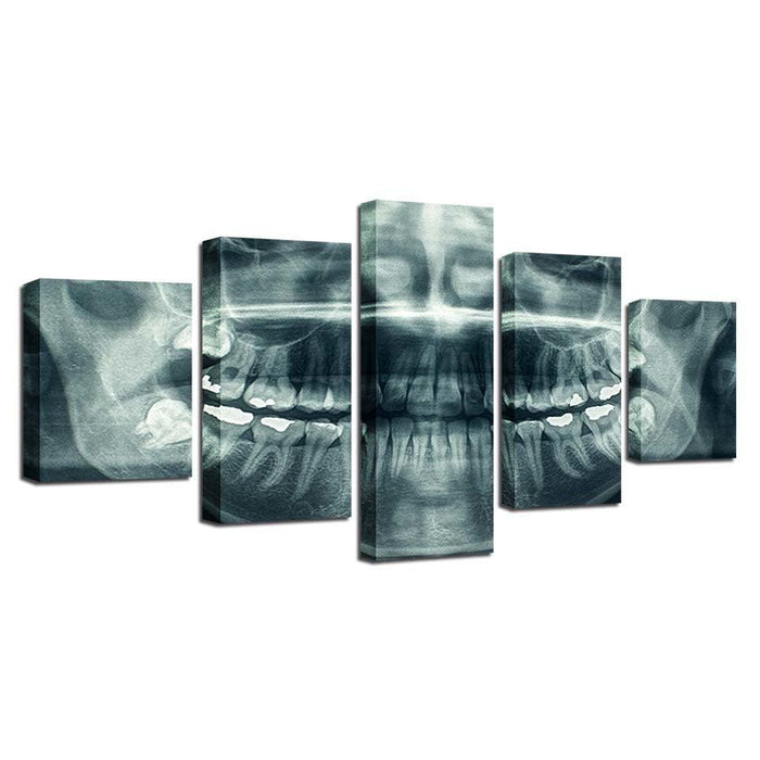 X-Ray Teeth 5 Piece HD Multi Panel Canvas Wall Art Frame